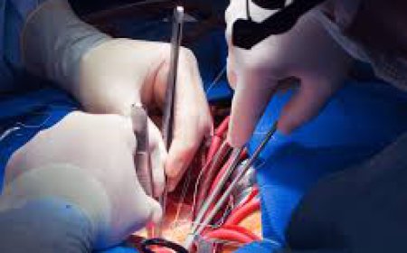 Your Guide to Cardiac Surgery