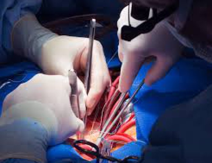 Your Guide to Cardiac Surgery