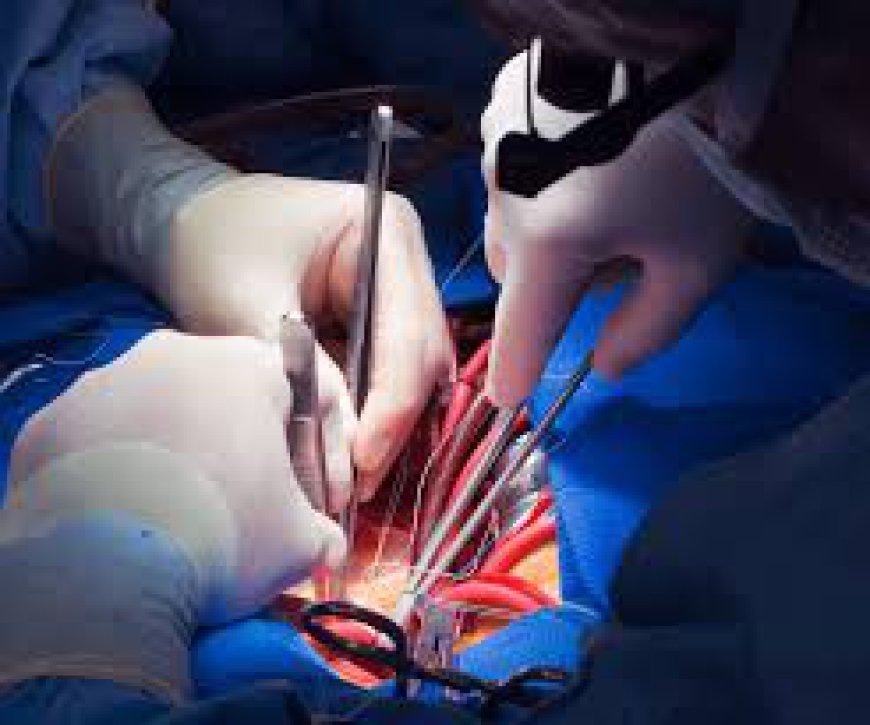 Your Guide to Cardiac Surgery