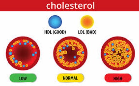 Gujarati - Is Cholesterol Eliminated or still there?