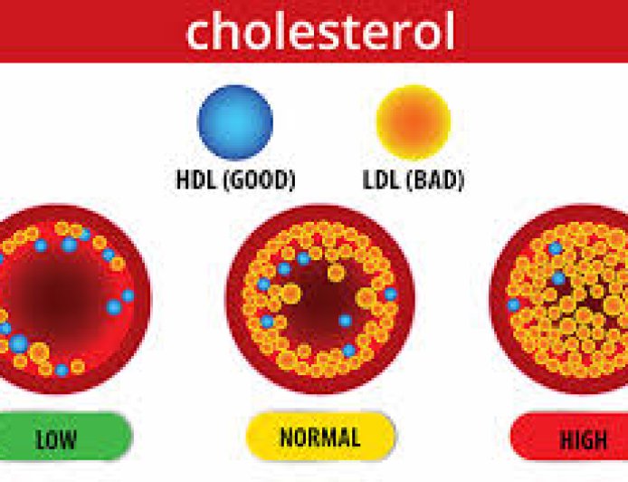 Gujarati - Is Cholesterol Eliminated or still there?